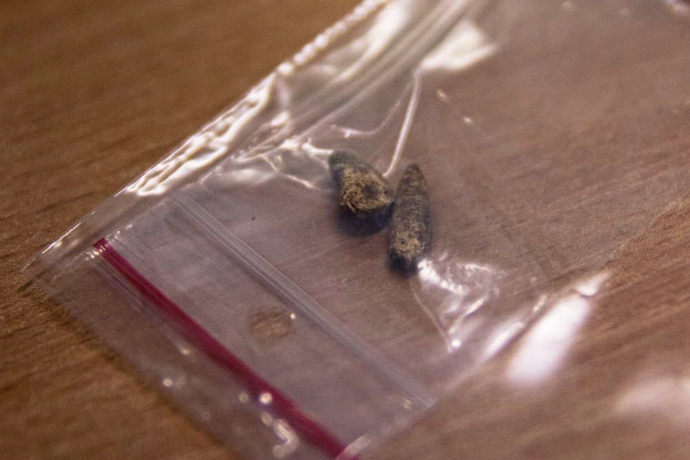 fragmenty korzeni zębów w woreczku strunowym