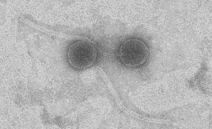 Próbka widok pod mikroskopem